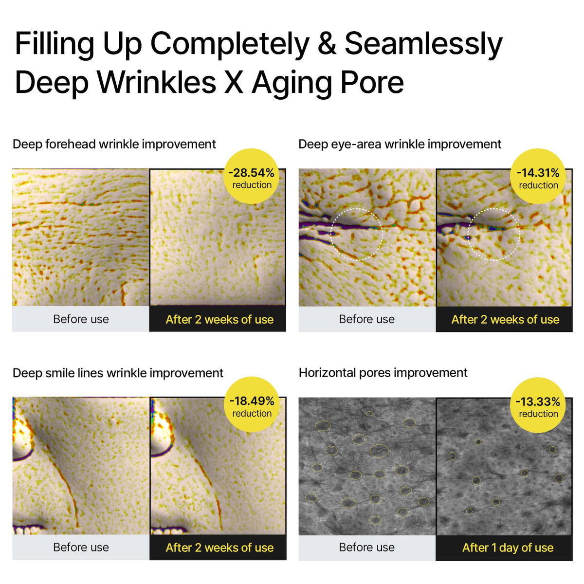 Celimax Vita-A Retinal Shot Tightening Booster with 0.1% Retinal, Matrixyl & Niacinamide | Pore Minimizer, Wrinkles & Fine Lines, Firmer Skin, Korean Face Serum (15ml)